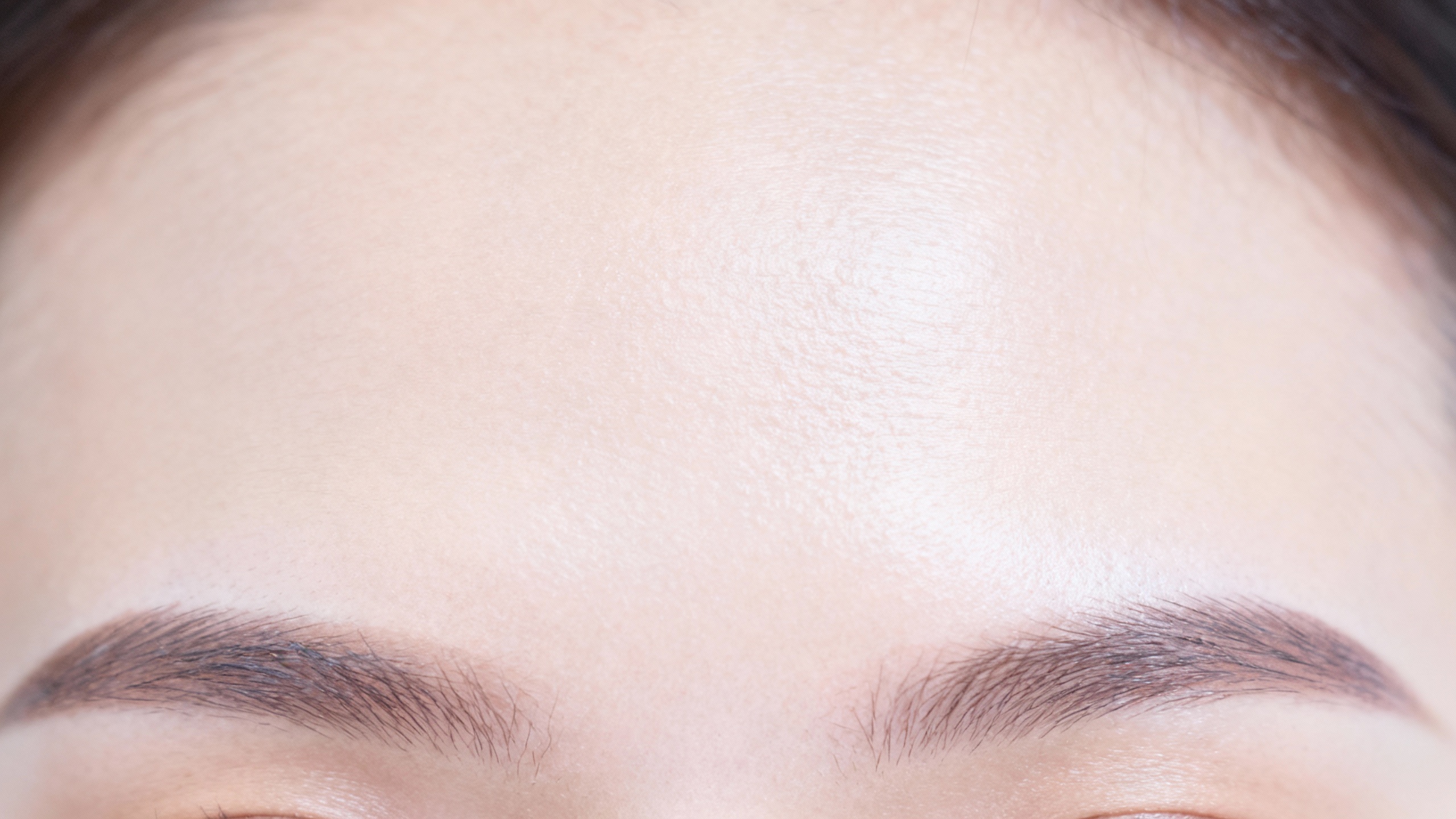 Featured image for What causes forehead acne?